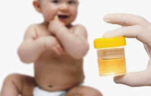 Повышены лейкоциты в моче у ребенка